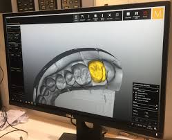 Computer image of teeth